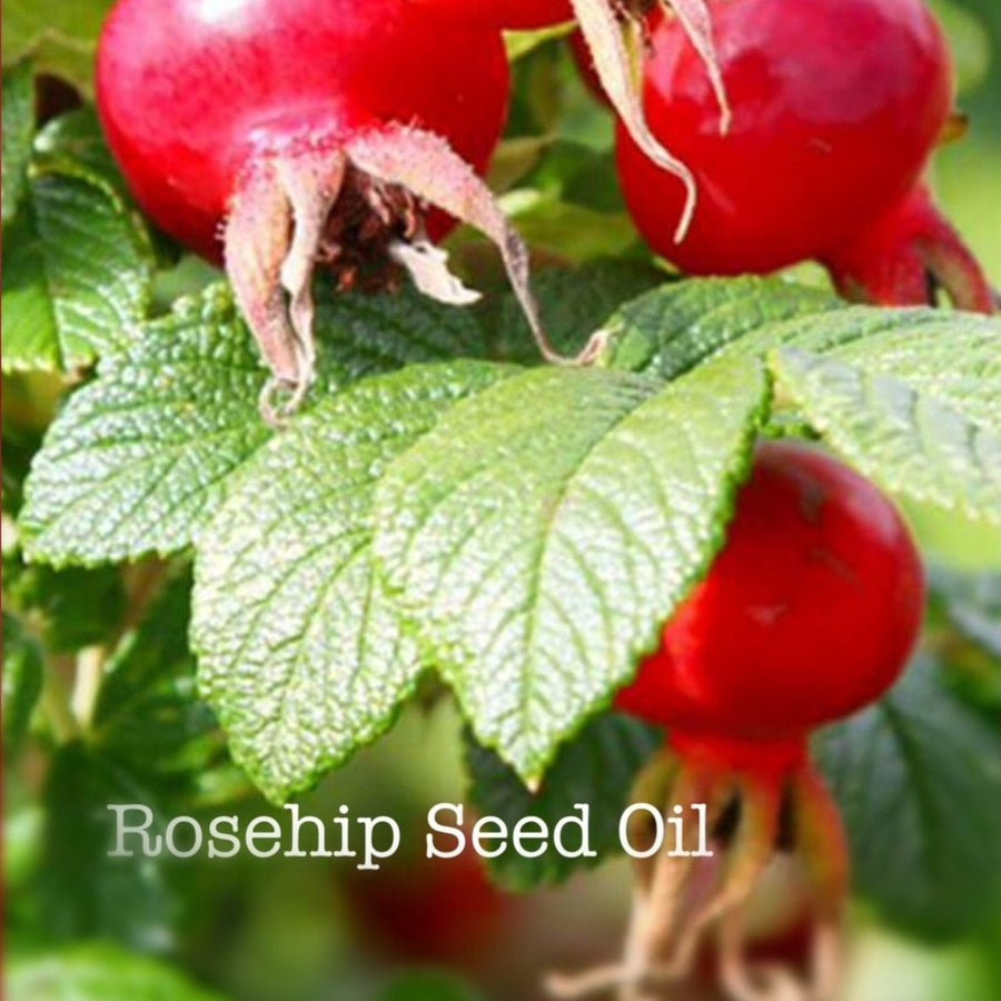 Restore Rosehip Day Moisturizer - for Rich Hydration and Rejuvenation